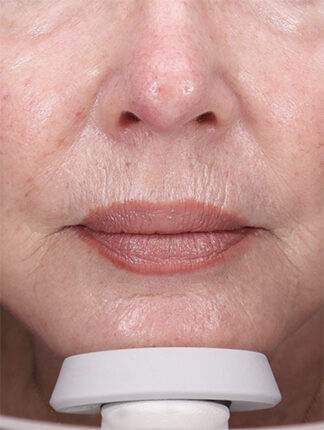 Case # 39 before photo