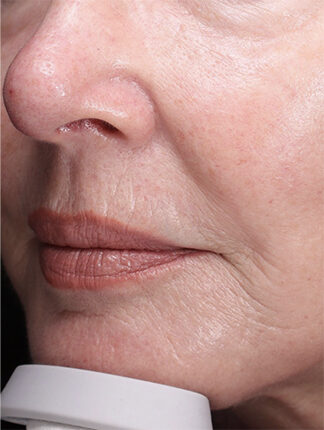 Case # 39 before photo