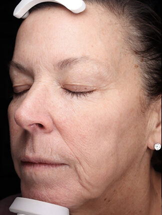 Case # 40 before photo