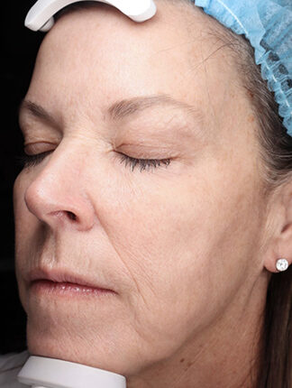 Case # 40 after photo