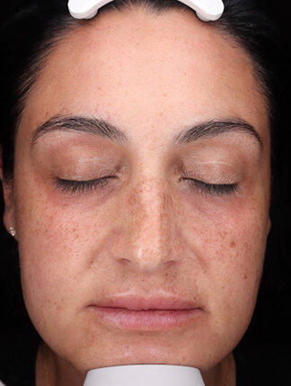 Case # 43 before photo