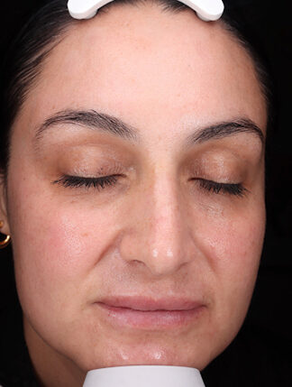 Case # 43 after photo