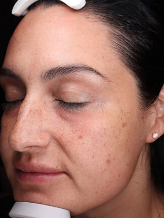 Case # 43 before photo