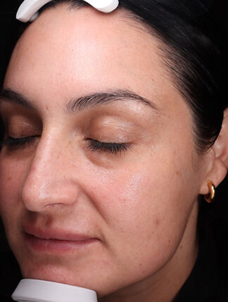 Case # 43 after photo