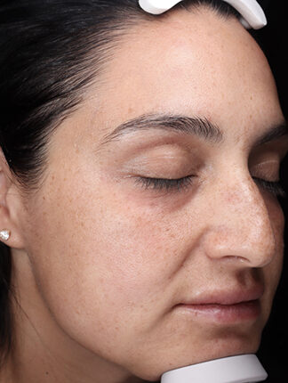 Case # 43 before photo