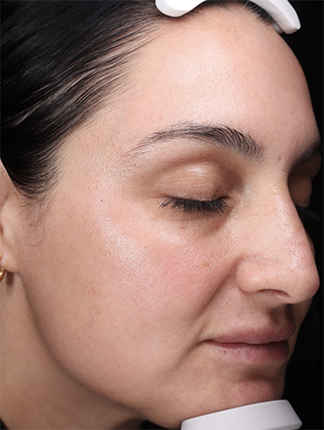 Case # 43 after photo