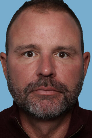 Case # 1 before photo