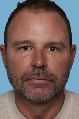 Case # 1 after photo