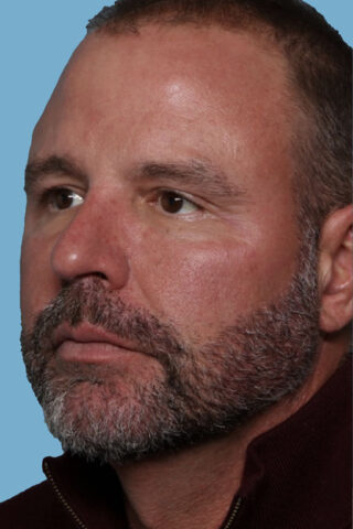 Case # 1 before photo