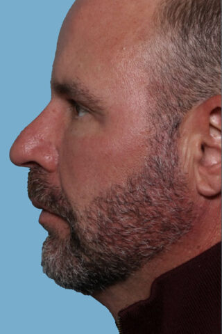 Case # 1 before photo