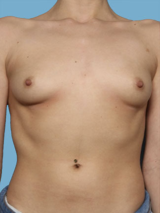 Case # 5 before photo