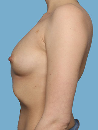 Case # 5 before photo