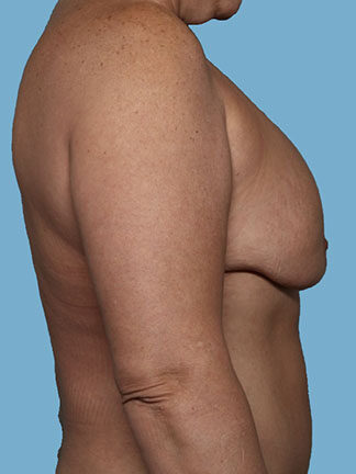 Case # 4 before photo