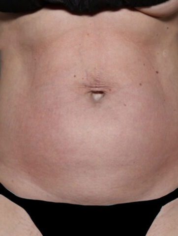 Case # 24 before photo