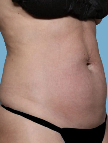 Case # 24 before photo