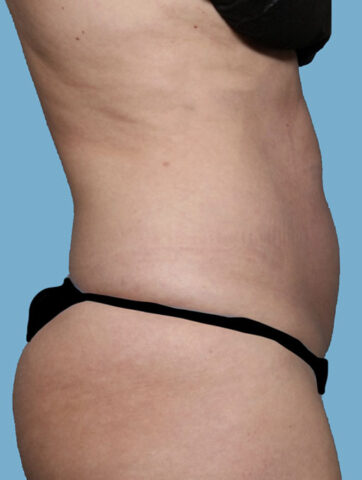 Case # 24 before photo