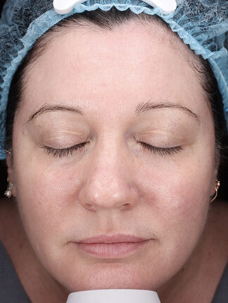 Case # 45 after photo