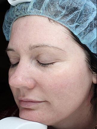 Case # 45 before photo