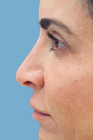 Case # 2 before photo