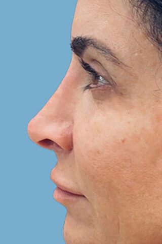 Case # 2 after photo