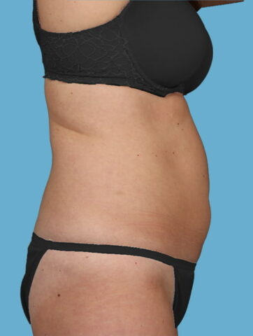 Case # 25 before photo