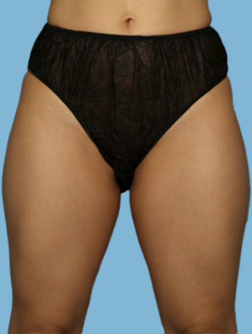 Case # 26 before photo