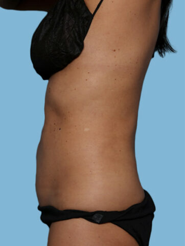 Case # 27 before photo