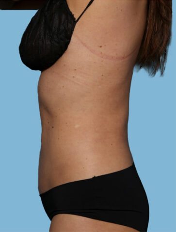 Case # 27 after photo