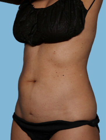 Case # 27 before photo