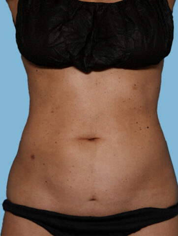 Case # 27 before photo