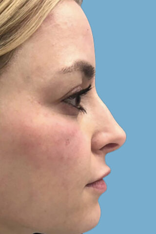 Case # 3 before photo