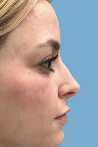 Case # 3 after photo