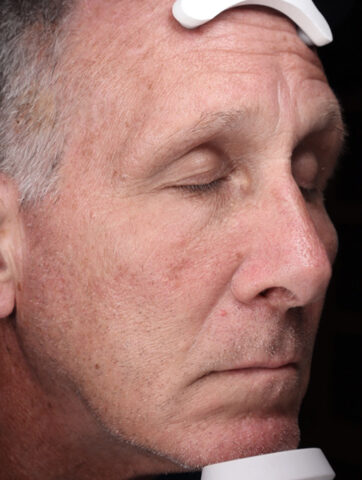 Case # 48 before photo