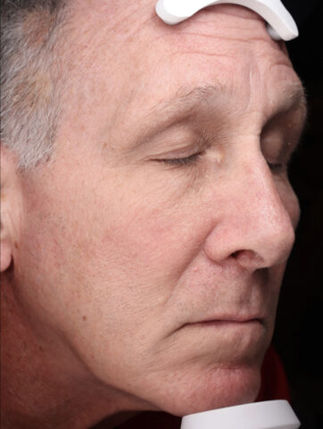 Case # 48 after photo