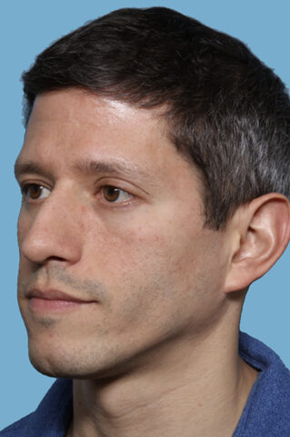 Case # 49 before photo