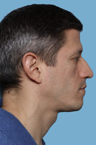 Case # 49 before photo