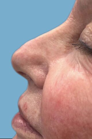 Case # 4 before photo