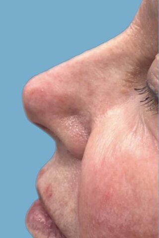 Case # 4 after photo