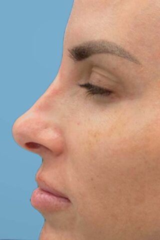 Case # 5 before photo