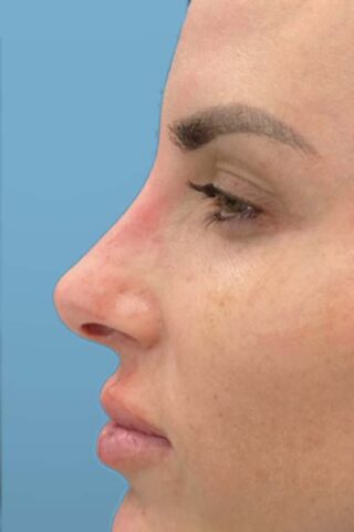 Case # 5 after photo