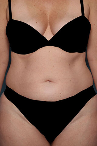 Case # 1 before photo