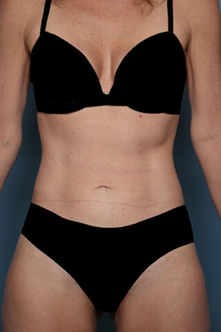 Case # 1 after photo