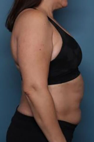 Case # 2 before photo