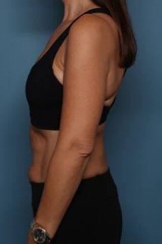 Case # 2 after photo