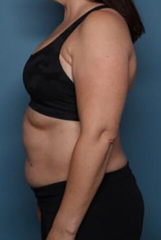 Case # 2 before photo