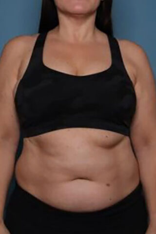 Case # 2 before photo