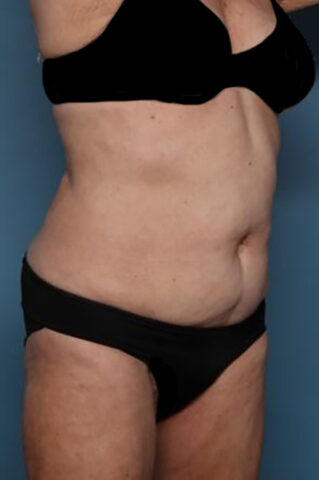 Case # 3 before photo