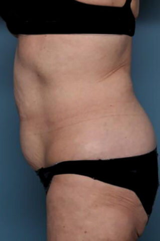 Case # 3 before photo