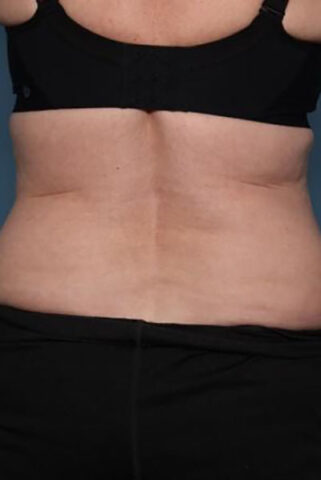 Case # 4 before photo