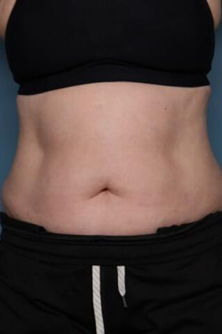 Case # 4 before photo